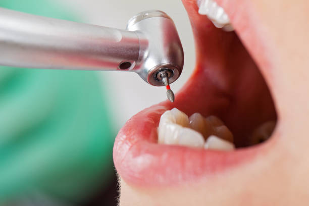 Emergency Dentist Open Today in CO